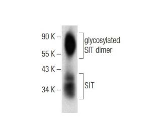 SIT Antibody (G-8) - Western Blotting - Image 131223