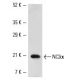 SK-BR-3 nuclear extract: sc-2134. Western blot analysis of NC2 alpha expression... 