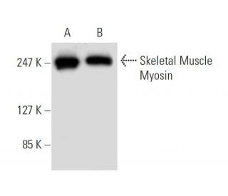 Skeletal Muscle Myosin Antibody (F59) - Western Blotting - Image 9119 