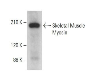 Skeletal Muscle Myosin Antibody (S58) - Western Blotting - Image 379685 