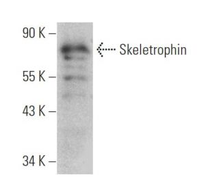 Skeletrophin Antibody (D-3) - Western Blotting - Image 372284