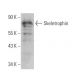 Skeletrophin Antibody (D-3) - Western Blotting - Image 372284