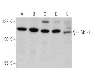 SKI-1 Antibody (A-11) - Western Blotting - Image 359944 