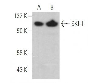 SKI-1 Antibody (A-11) - Western Blotting - Image 368362 