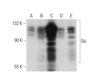 western blotting image from recommended Ski (G8) monoclonal antibody replacement. Image 320920