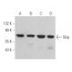 western blotting image from recommended Skip (D-5) monoclonal antibody replacement. Image 364367