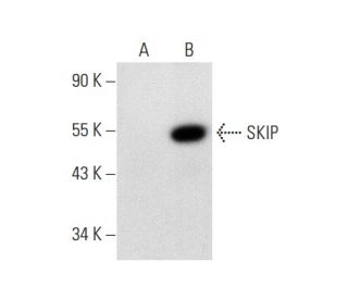 SKIP Antibody (B-6) - Western Blotting - Image 139179Each CRISPR/Cas9 Knockout (KO) Plasmid product consists of a pool of 3 plasmids designed to ensure identification and cleavage of a specific gene for maximum knockout efficiency. Each plasmid encodes a unique 20 nt sequence derived from the GeCKO (v2) library.