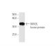 SKIV2L Antibody (1E5) - Western Blotting - Image 348842
