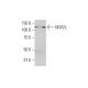 SKIV2L Antibody (1E5) - Western Blotting - Image 352142 