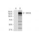 SKIV2L Antibody (1E5) - Western Blotting - Image 352143 
