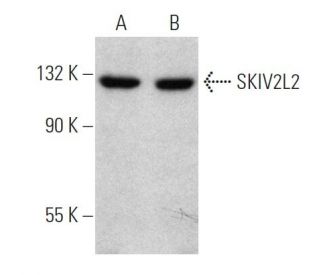 SKIV2L2 Antibody (H-9) - Western Blotting - Image 368551 