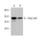 western blotting image from recommended Skp2 p45 (A-2) monoclonal antibody replacement. Image 379223