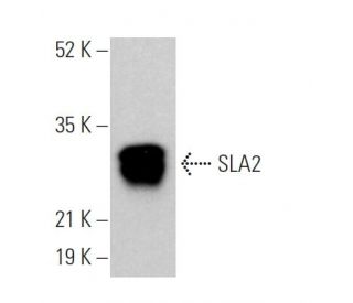 SLA2 Antibody (E-8) - Western Blotting - Image 369038 