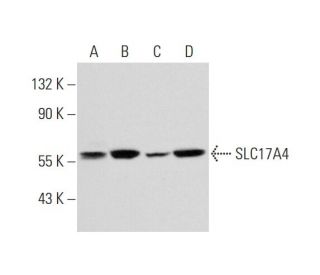 SLC17A4 Antibody (NQ-C19) - Western Blotting - Image 295602 