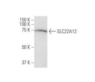 SLC22A12 Antibody (2B5) - Western Blotting - Image 347636 