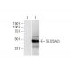 SLC25A25 Antibody (4D8) - Western Blotting - Image 352227 