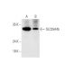 SLC25A45 Antibody (C-6) - Western Blotting - Image 332750 