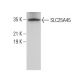 SLC25A45 Antibody (C-6) - Western Blotting - Image 375604