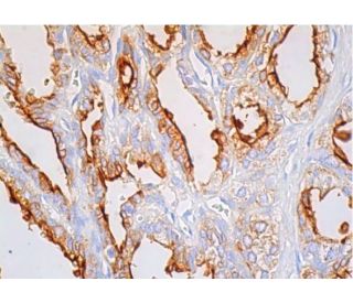 SLC26A3 Antibody (H-8) - Immunohistochemistry - Image 386002 
