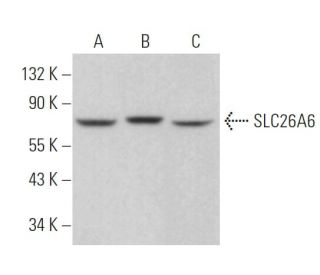 western blotting image from recommended SLC26A6 (F-5) monoclonal antibody replacement. Image 371101