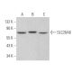 western blotting image from recommended SLC26A6 (F-5) monoclonal antibody replacement. Image 371101