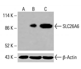 SLC26A6 Antibody (F-5) - Western Blotting - Image 415969 