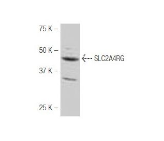 SLC2A4RG Antibody (K-41) - Western Blotting - Image 54011 