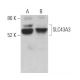 SLC43A3 Antibody (E-10) - Western Blotting - Image 371120 
