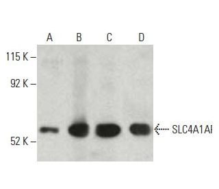 SLC4A1AP Antibody (49) - Western Blotting - Image 396648 