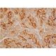 SLC4A4 Antibody (G-9) - Immunohistochemistry - Image 386805