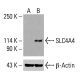 SLC4A4 Antibody (G-9) - Western Blotting - Image 416023