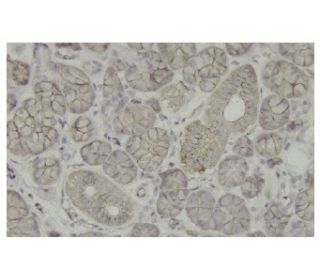 SLC4A8 Antibody (LX-2) - Immunohistochemistry - Image 36113