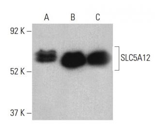 SLC5A12 Antibody (H-4) - Western Blotting - Image 399415 