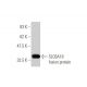 SLC6A19 Antibody (4F11) - Western Blotting - Image 350362