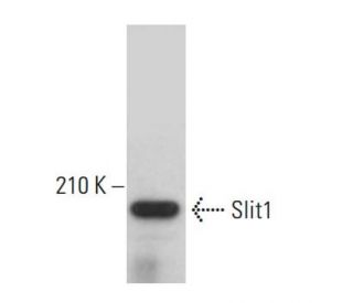 western blotting image from recommended Slit1 (G-4) monoclonal antibody replacement. Image 382686