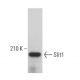 western blotting image from recommended Slit1 (G-4) monoclonal antibody replacement. Image 382686
