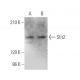 Slit2 Antibody (F-7) - Western Blotting - Image 373469
