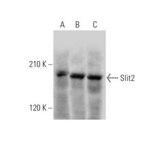 western blotting image from recommended Slit2 (F-7) monoclonal antibody replacement. Image 320877