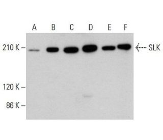 SLK Antibody (G-9) - Western Blotting - Image 348640 