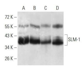 SLM-1 Antibody (7G8C10) - Western Blotting - Image 358320 