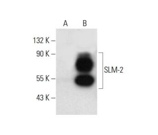 SLM-2 Antibody (F-3) - Western Blotting - Image 308438 