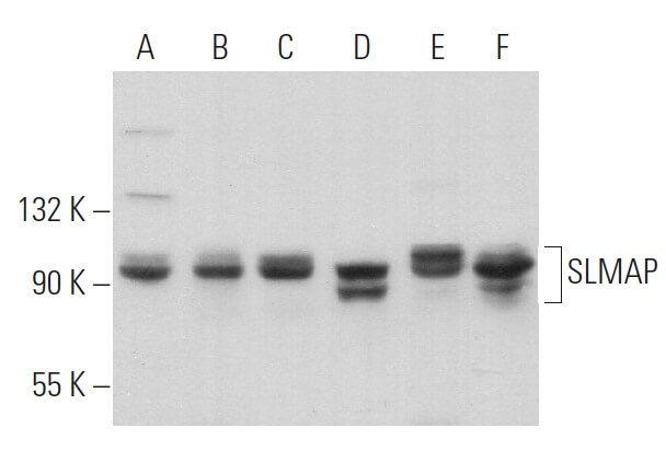 SLMAP Antibody (B-9) | SCBT - Santa Cruz Biotechnology