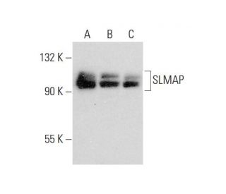 SLMAP Antibody (SJ-09) - Western Blotting - Image 308601 