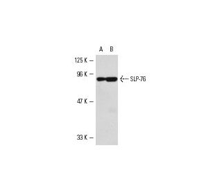 western blotting image from recommended SLP-76 (F-7) monoclonal antibody replacement. Image 5035