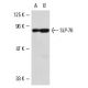 western blotting image from recommended SLP-76 (F-7) monoclonal antibody replacement. Image 5035