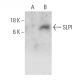 SLPI Antibody (F-12) - Western Blotting - Image 359437