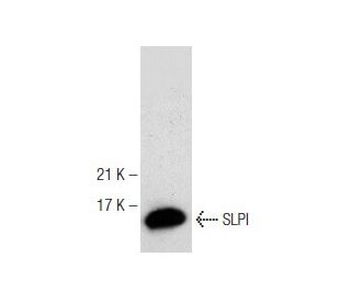 SLPI Antibody (F-12) - Western Blotting - Image 148840The Double Nickase Plasmid features a U6 promoter for sgRNA expression, a 20 nt targeting sequence, and a gRNA scaffold to guide Cas9n. It includes a CBh promoter for Cas9n (D10A) and puromycin resistance, GFP for transfection verification, and nuclear localization signals (NLS). The 2A peptide allows co-expression of Cas9n and Puro from a single promoter, enabling precise genome editing with reduced off-target effects.