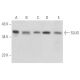 This polyclonal antibody has been discontinued. See our recommended <a href="slug-antibody-a-7">SLUG (A-7)</a> monoclonal antibody (sample data shown). western blotting image from recommended SLUG (A-7) monoclonal antibody replacement. Image 355450
