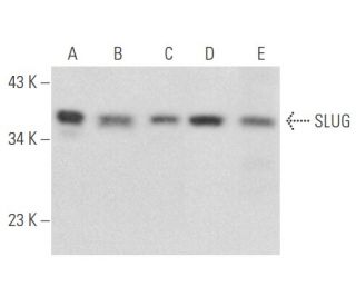 western blotting image from recommended SLUG (A-7) monoclonal antibody replacement. Image 355450