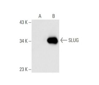SLUG Antibody (A-7) - Western Blotting - Image 81071 